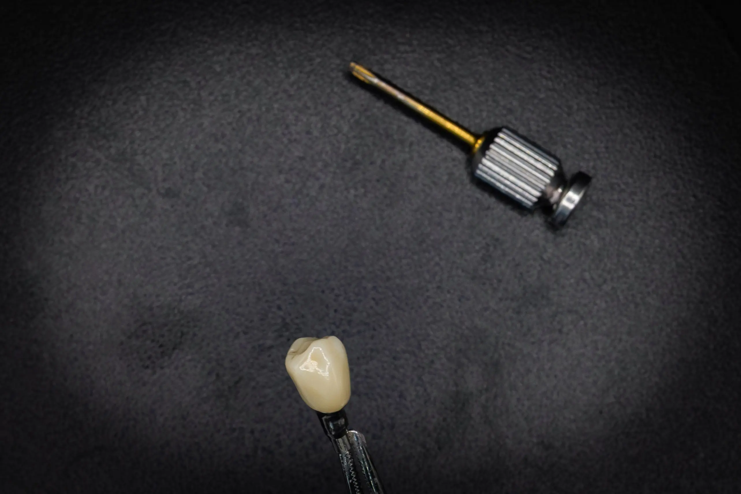 Implantaatwerk voorbeeld 2