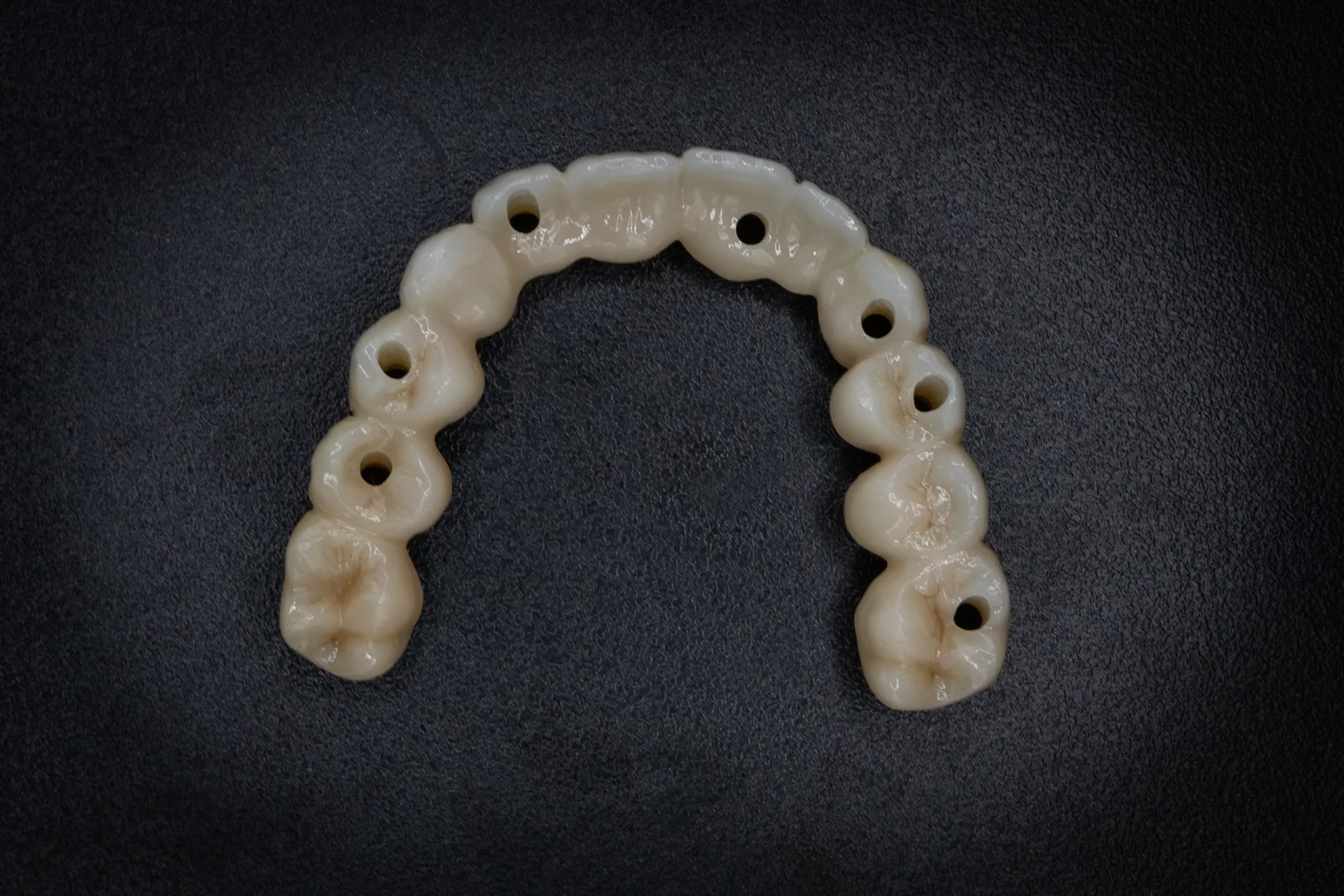 Implantaatwerk voorbeeld 5