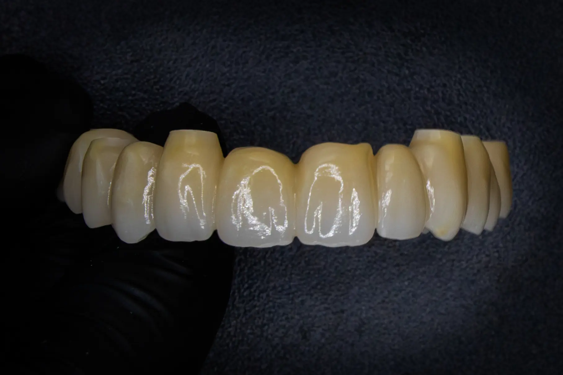 Implantaatwerk voorbeeld 6