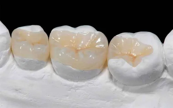 Kroon/brug voorbeeld 2