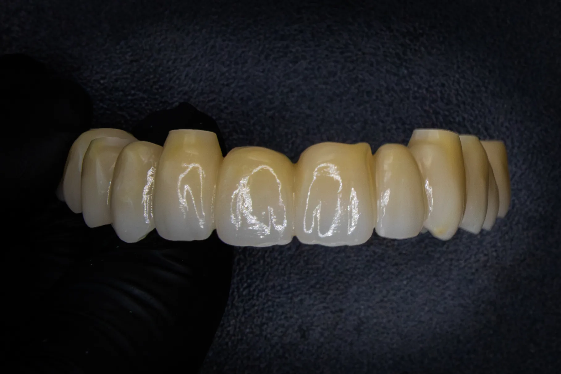 Implantaatwerk voorbeeld 6